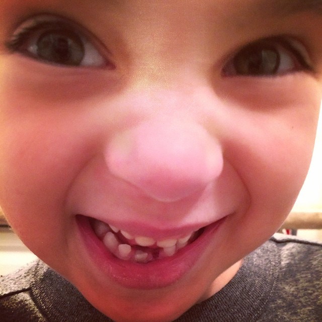 Out of nowhere O's tooth got real wiggly and fell out! Whaaaaaaaaattt?